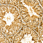 ALDH1A1 Antibody in Immunohistochemistry (Paraffin) (IHC (P))