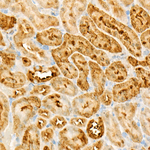 ALDH1A1 Antibody in Immunohistochemistry (Paraffin) (IHC (P))
