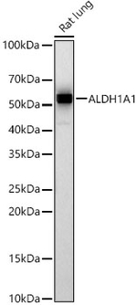 ALDH1A1 Antibody in Western Blot (WB)