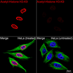 H3K9ac Antibody in Immunocytochemistry (ICC/IF)