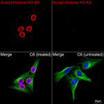 H3K9ac Antibody in Immunocytochemistry (ICC/IF)