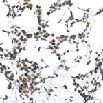 H3K9ac Antibody in Immunohistochemistry (Paraffin) (IHC (P))