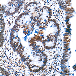 H3K9ac Antibody in Immunohistochemistry (Paraffin) (IHC (P))