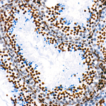 H3K9ac Antibody in Immunohistochemistry (Paraffin) (IHC (P))