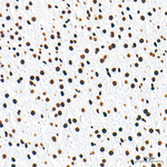 H3K9ac Antibody in Immunohistochemistry (Paraffin) (IHC (P))