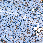 H3K9ac Antibody in Immunohistochemistry (Paraffin) (IHC (P))
