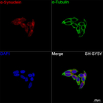 alpha Synuclein Antibody in Immunocytochemistry (ICC/IF)