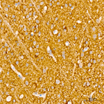 alpha Synuclein Antibody in Immunohistochemistry (Paraffin) (IHC (P))