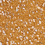 alpha Synuclein Antibody in Immunohistochemistry (Paraffin) (IHC (P))