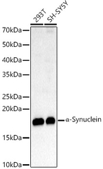 alpha Synuclein Antibody in Western Blot (WB)