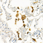 CD71 Antibody in Immunohistochemistry (Paraffin) (IHC (P))