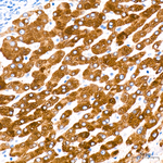 CYP2E1 Antibody in Immunohistochemistry (Paraffin) (IHC (P))