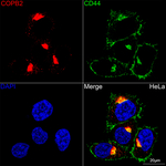 COPB2 Recombinant Rabbit Monoclonal Antibody (3E5V7)