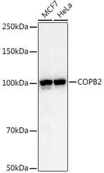 COPB2 Antibody in Western Blot (WB)
