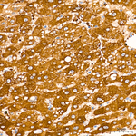FTCD Antibody in Immunohistochemistry (Paraffin) (IHC (P))