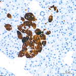 FTCD Antibody in Immunohistochemistry (Paraffin) (IHC (P))