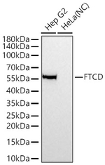 FTCD Antibody in Western Blot (WB)