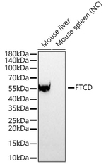 FTCD Antibody in Western Blot (WB)