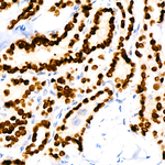Nkx2.1 Antibody in Immunohistochemistry (Paraffin) (IHC (P))