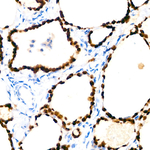 Nkx2.1 Antibody in Immunohistochemistry (Paraffin) (IHC (P))