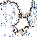 Nkx2.1 Antibody in Immunohistochemistry (Paraffin) (IHC (P))