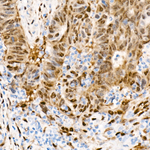 YAP1 Antibody in Immunohistochemistry (Paraffin) (IHC (P))
