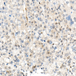 YAP1 Antibody in Immunohistochemistry (Paraffin) (IHC (P))