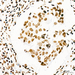 H4K20me2 Antibody in Immunohistochemistry (Paraffin) (IHC (P))