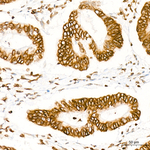 H4K20me2 Antibody in Immunohistochemistry (Paraffin) (IHC (P))
