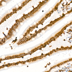 H4K20me2 Antibody in Immunohistochemistry (Paraffin) (IHC (P))