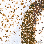 H4K20me2 Antibody in Immunohistochemistry (Paraffin) (IHC (P))