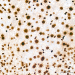 H4K20me2 Antibody in Immunohistochemistry (Paraffin) (IHC (P))