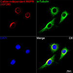 IGF2R Antibody in Immunocytochemistry (ICC/IF)