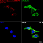 IGF2R Recombinant Rabbit Monoclonal Antibody (2J8W7)