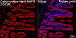IGF2R Antibody in Immunohistochemistry (Paraffin) (IHC (P))