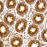 IGF2R Antibody in Immunohistochemistry (Paraffin) (IHC (P))