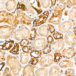 IGF2R Antibody in Immunohistochemistry (Paraffin) (IHC (P))