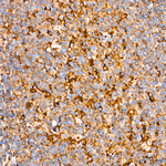IGF2R Antibody in Immunohistochemistry (Paraffin) (IHC (P))