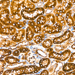 IGF2R Antibody in Immunohistochemistry (Paraffin) (IHC (P))