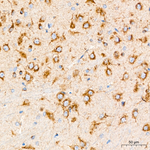 IGF2R Antibody in Immunohistochemistry (Paraffin) (IHC (P))