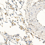 FADD Antibody in Immunohistochemistry (Paraffin) (IHC (P))