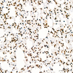 Histone H3 Antibody in Immunohistochemistry (Paraffin) (IHC (P))
