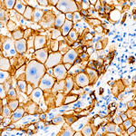 E-Cadherin Antibody in Immunohistochemistry (Paraffin) (IHC (P))
