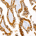 E-Cadherin Antibody in Immunohistochemistry (Paraffin) (IHC (P))