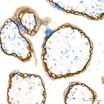 E-Cadherin Antibody in Immunohistochemistry (Paraffin) (IHC (P))