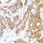 E-Cadherin Antibody in Immunohistochemistry (Paraffin) (IHC (P))