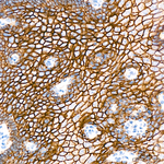 E-Cadherin Antibody in Immunohistochemistry (Paraffin) (IHC (P))