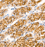 E-Cadherin Antibody in Immunohistochemistry (Paraffin) (IHC (P))