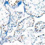 Cyclin E Recombinant Rabbit Monoclonal Antibody (4Q5B4)