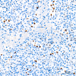 Cyclin E Antibody in Immunohistochemistry (Paraffin) (IHC (P))
